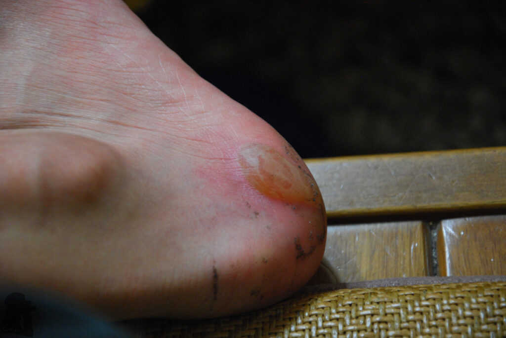 The Full Text of "Hiking Safety in Taiwan" blister