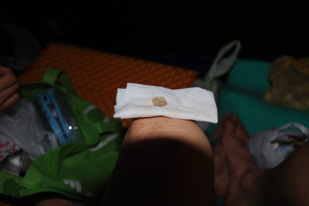 Nenggao-Andongjun Trail (能高安東軍); Hiking on the Dreamy Alpine Grassland The piece of skin peeled off from my heel’s blister